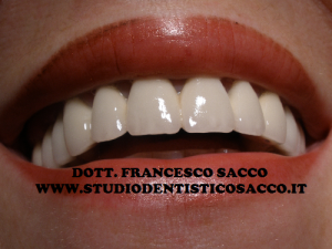 www.studiodentisticosacco.it