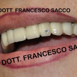 Implantolgia Salerno DR.SACCO