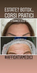 BOTOX DR. FRANCESCO SACCO SALERNO